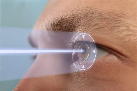 czech republic eye surgery reviews.